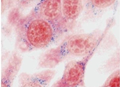 cells and nps